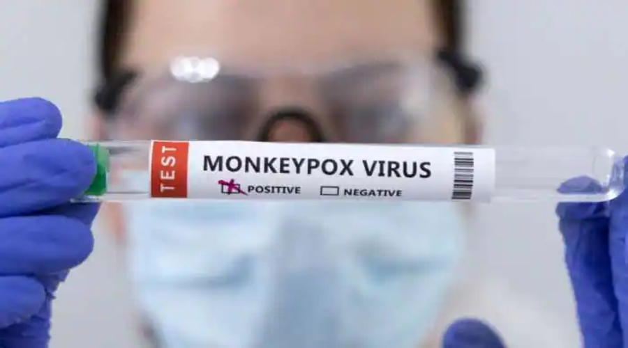 MonkeyPox Outbreak